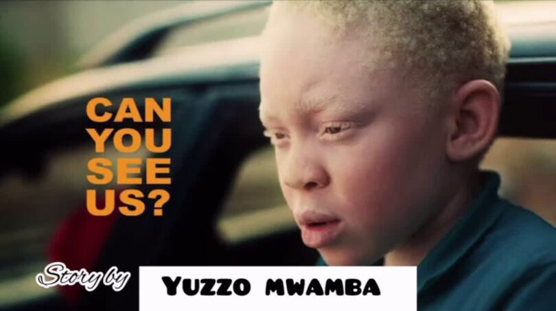 AUDIO Yuzzo Mwamba - Story Ya Albino DOWNLOAD